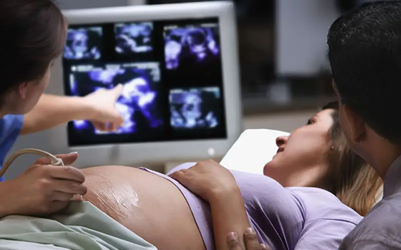 Fetal Ekokardiyografi