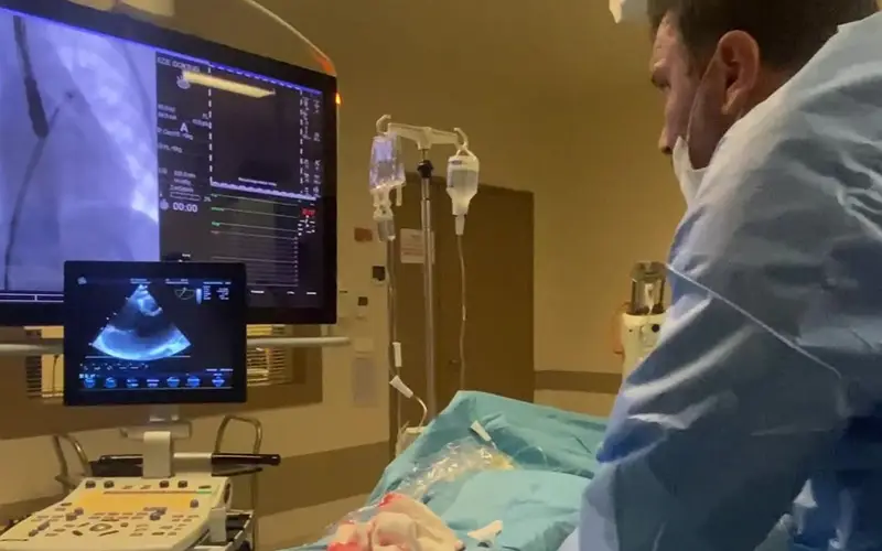 Transkateterle ASD Kapatılma İşlemi