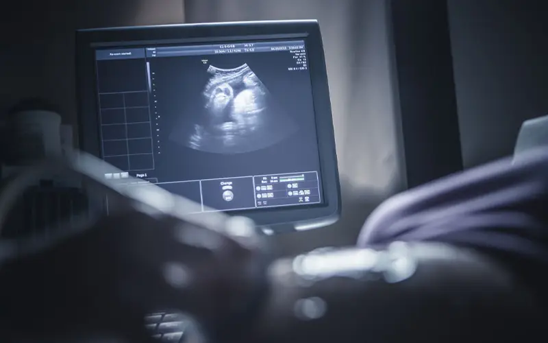 Anne Karnında Kalp Hastalıklarının Tanısı